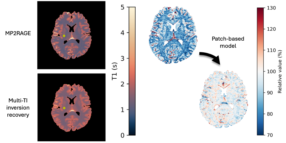 Quantitative T1 bias correction model