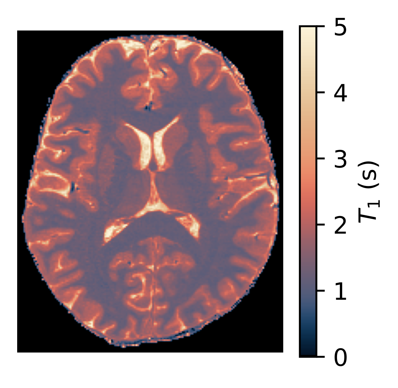 quantitative T1 map of brain